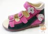 Szamos supinált lány szandál lila-pink, katica mintával 35
